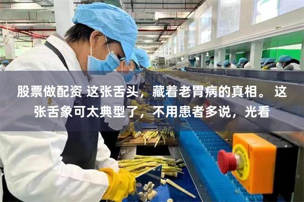 股票做配资 这张舌头,藏着老胃病的真相。 这张舌象可太典型了,不用患者多说,光看